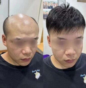 西峽縣隱形假發(fā)定制透氣性好