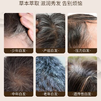 烏發(fā)滋養(yǎng)精華液
