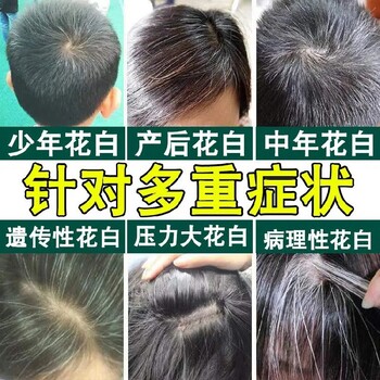 烏發(fā)滋養(yǎng)精華液