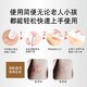 楊浦蚊蟲叮咬止癢器圖