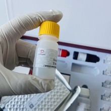 推荐：鸡跨膜丝氨酸蛋白酶2(TMPRSS2)ELISA试剂盒