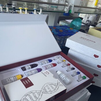 人半乳凝集素9(GAL9)ELISA試劑盒靈敏度高