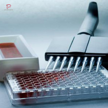 兔肿瘤蛋白P53(TP53)ELISA试剂盒图片