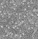 CFPAC-1人胰腺癌細胞百歐博偉生物細胞系
