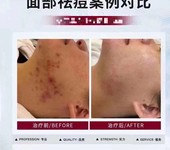 广州斑痘敏OEM生产厂家-化妆品源头工厂批发-院线美容院定制