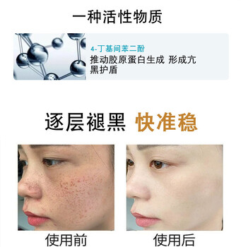 美容院徒手揉斑液批發(fā)拿貨OEM貼牌代加工化妝品廠家