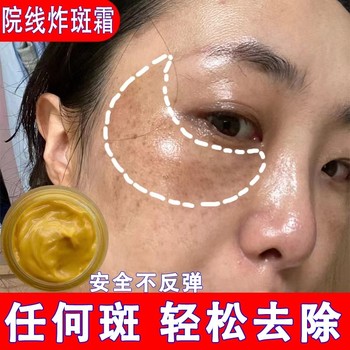 院线美白淡斑霜护肤品炸斑霜批发拿货OEM贴牌代加工化妆品厂家