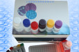克氏锥虫探针法荧光定量PCR试剂盒