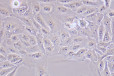 大鼠乳腺成纤维细胞