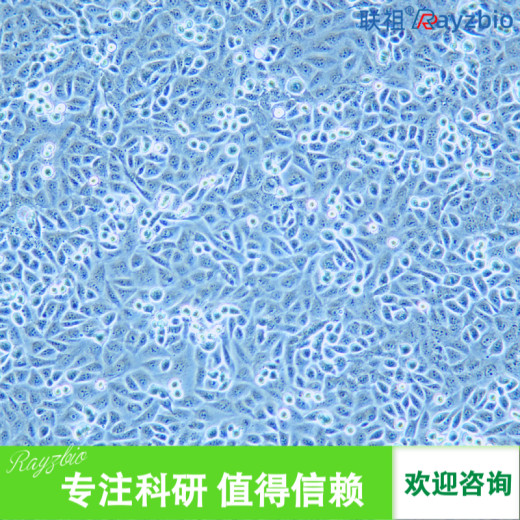 兔前列腺成纤维细胞