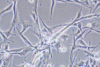 大鼠肝星状细胞